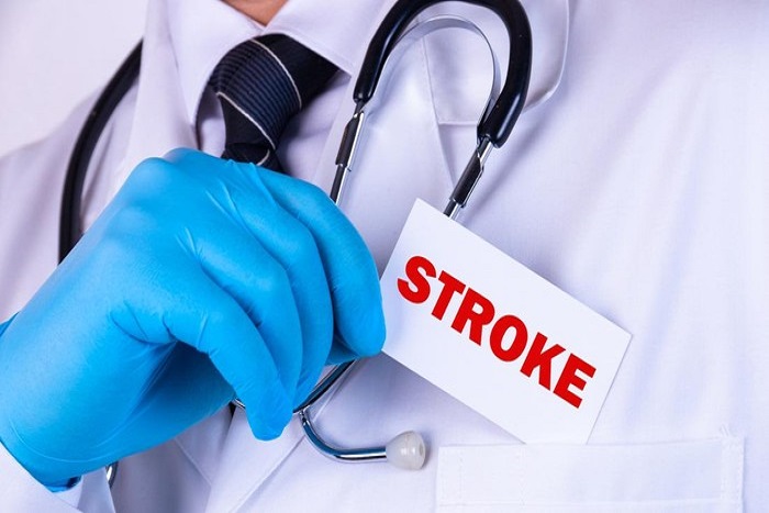 Gejala Stroke yang Harus Diwaspadai, Siapa Tahu Kamu Pernah tidak Sadar Mengalaminya