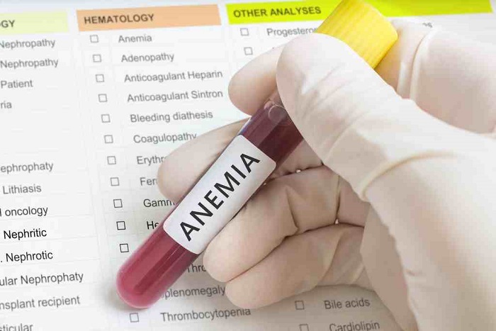 Berbeda dengan Anemia Biasa, Ini 4 Solusi Penderita Anemia Sideroblastik